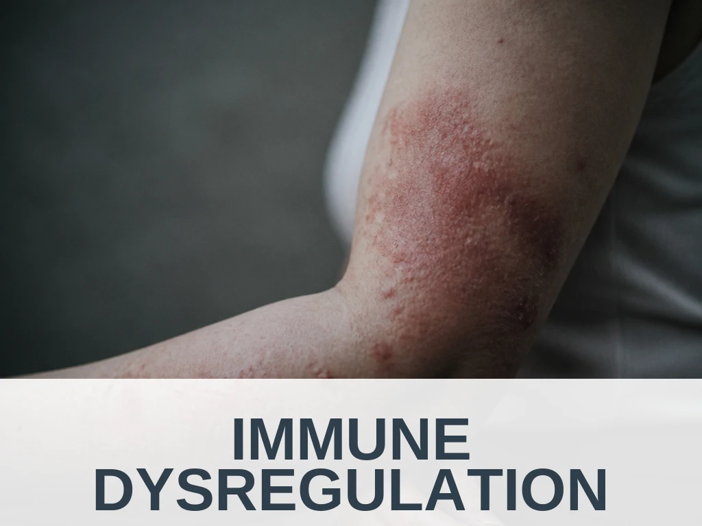 Immune Dysregulation